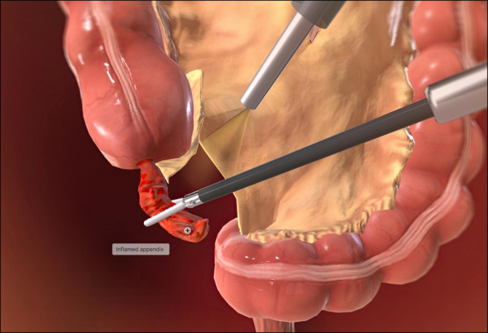 appendix