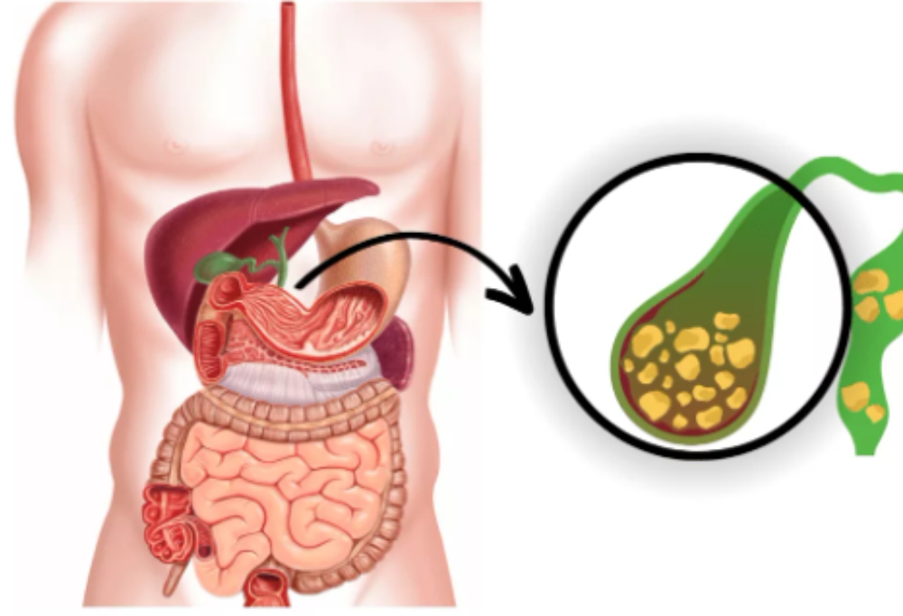 gallbladder